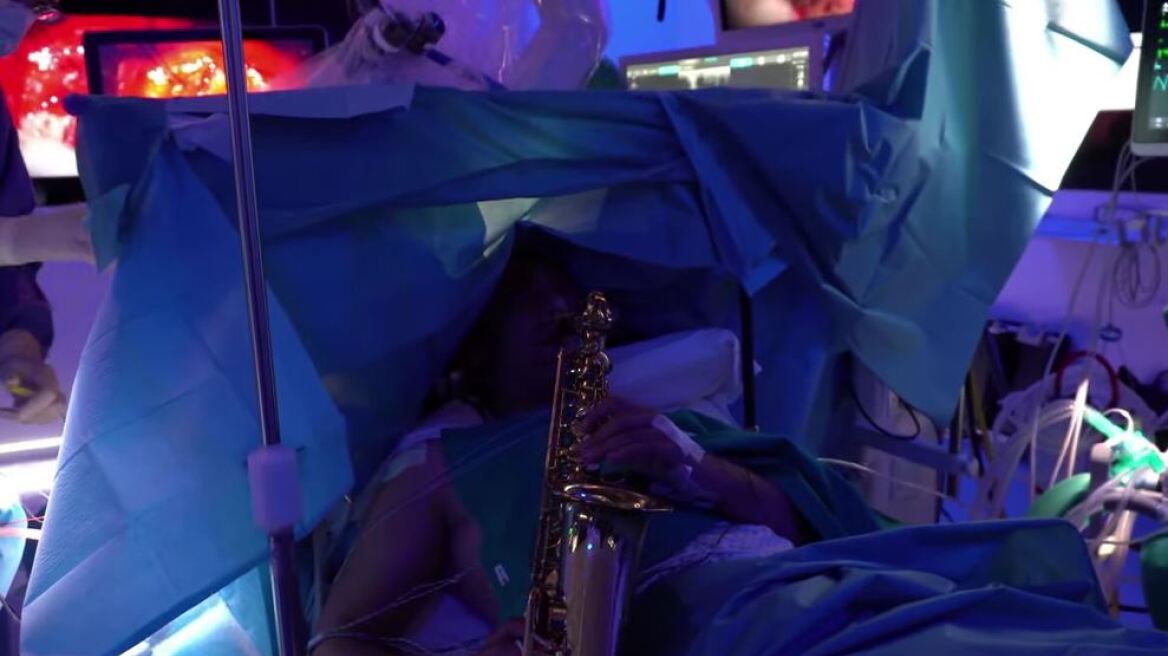 Ιταλία: Ασθενής παίζει σαξόφωνο σε 9ωρη εγχείρηση αφαίρεσης όγκου  από τον εγκέφαλο – Δείτε βίντεο