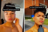 «Μην σπάτε σκόπιμα τα οστά στο πρόσωπό σας» – Πώς το «bone smashing» επηρεάζει τα νεαρά αγόρια στο TikTok